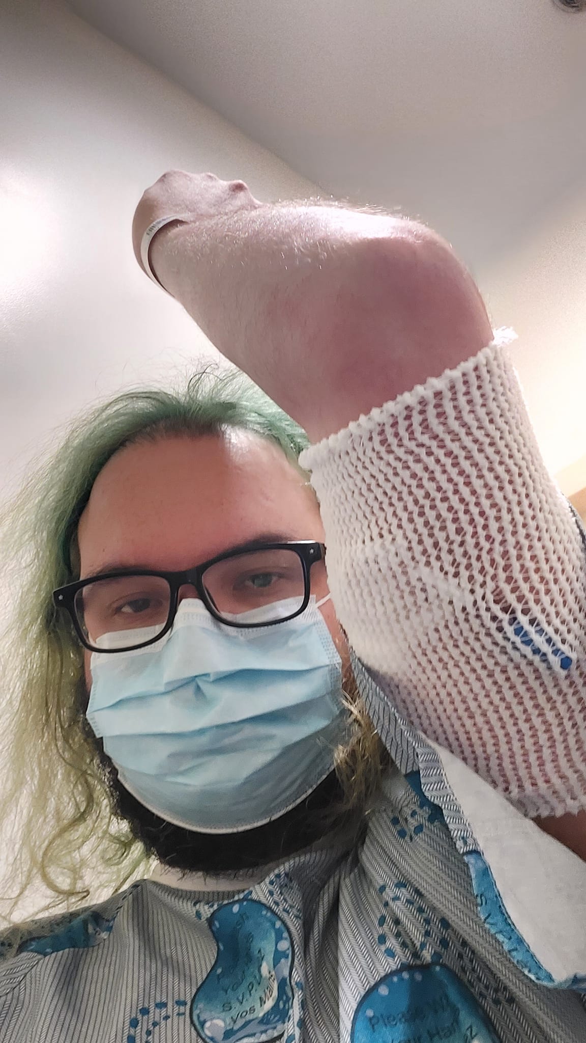 A man with green hair and a beard is wearing a hospital gown, holding his arm up showing off a fabric mesh on his upper arm, which protects his new PICC